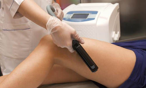 Hair Laser Removal Treatment