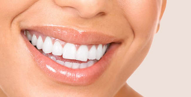 Teeth Whitening Procedures