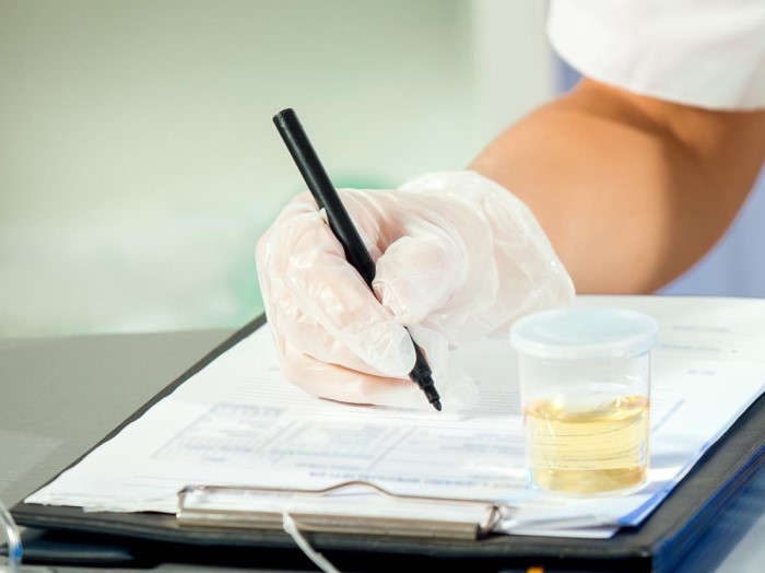 Alcohol and Drug Testing Services